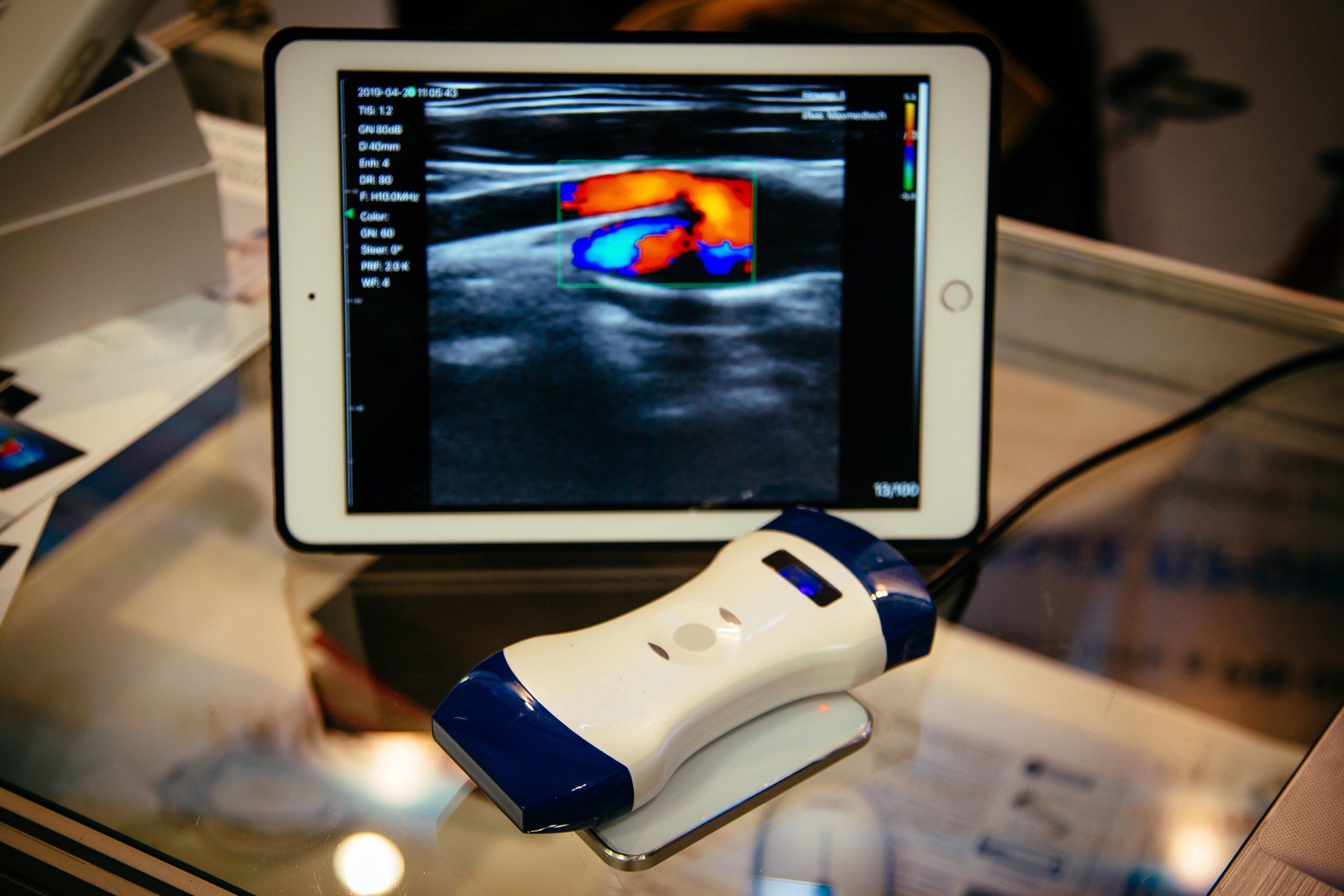 Facial Ultrasound Imaging and Complications Management