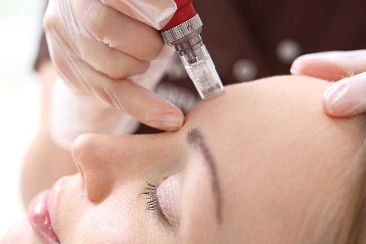 Medical Microneedling