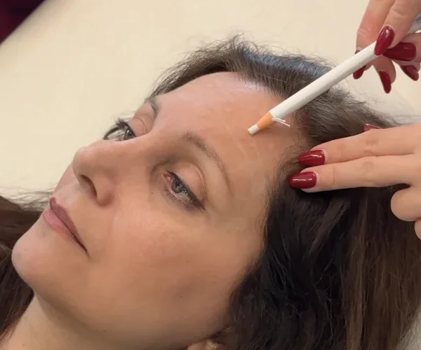 How to Practice Facial Mapping as a Beginner Injector