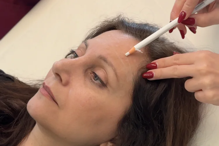 How to Practice Facial Mapping as a Beginner Injector