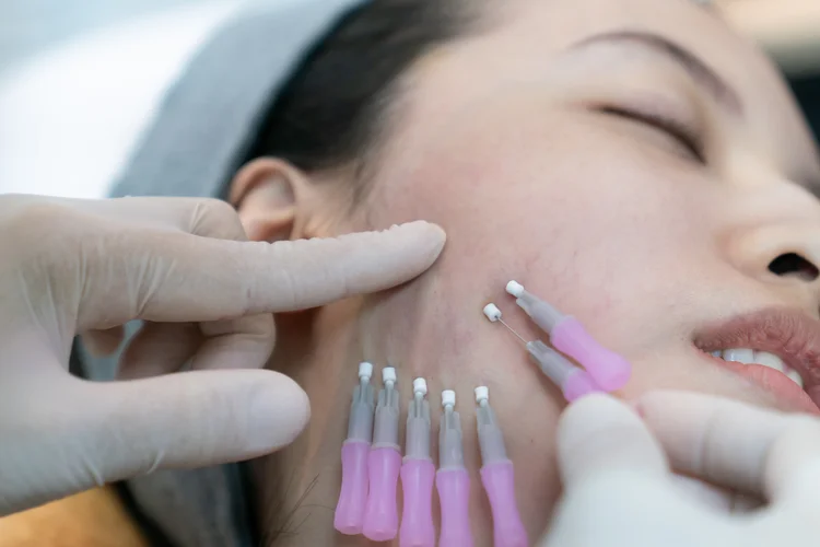 Thread Lifts vs. Surgical Facelifts: Pros and Cons