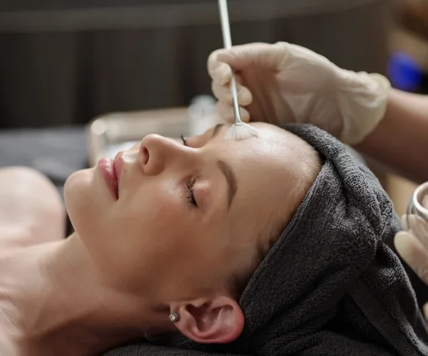 Why Chemical Peels Are Perfect for Fall and Winter 🍂❄️