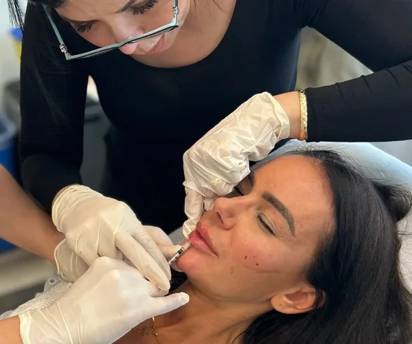 Lip Fillers: What Clients Really Want in Canada