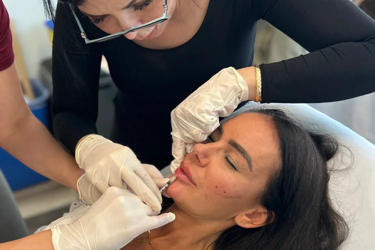 Lip Fillers: What Clients Really Want in Canada