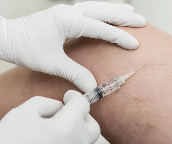Master Sclerotherapy: Expand Your Aesthetic Practice