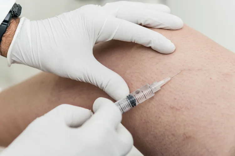 Master Sclerotherapy: Expand Your Aesthetic Practice