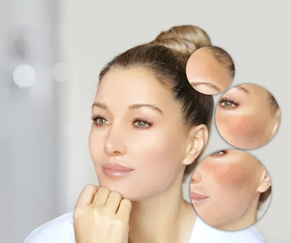 The Role of Nutrition in Skin Health: Advice to Share With Clients