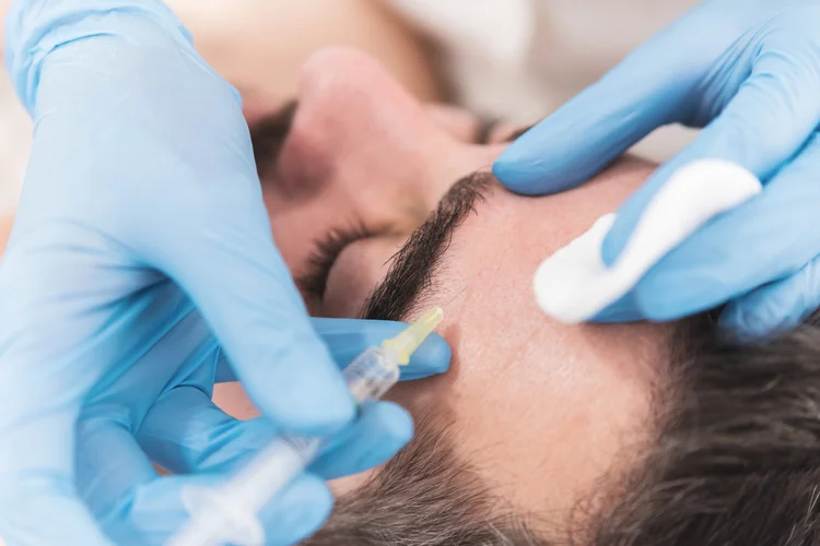 Top 5 Questions Clients Ask About Microneedling—Answered