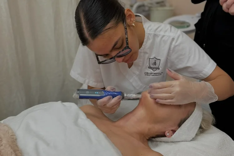 Why Add Microneedling to Your Services?