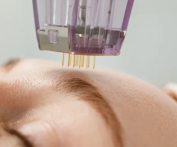 Why the Demand for Facial Aesthetics Is Rising